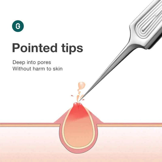 Precision Tweezers for Ingrown Hair - Stainless Steel Pointed Tweezers for Splinters & Blackhead Removal - Flexivo