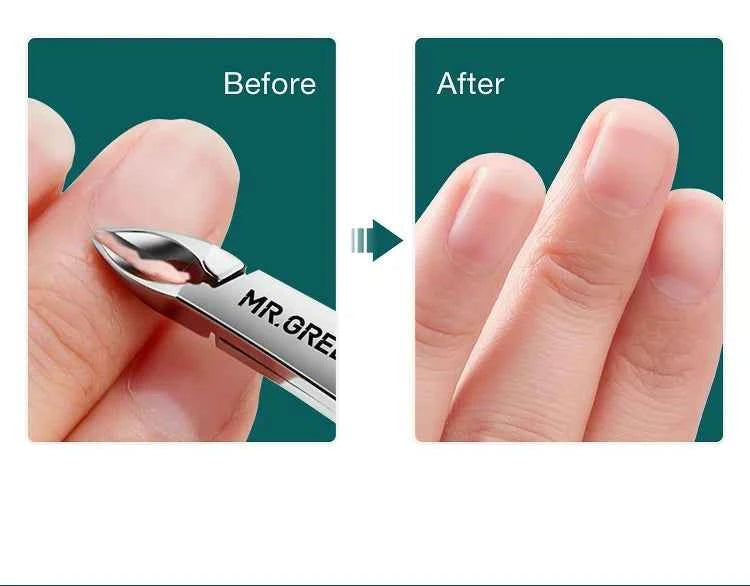 Precision Cuticle Scissors - Medical-Grade Stainless Steel for Perfect Grooming - Flexivo