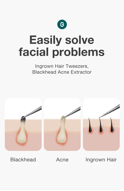 Precision Pointed Tweezers - Stainless Steel for Ingrown Hair, Splinters & Blackhead Removal