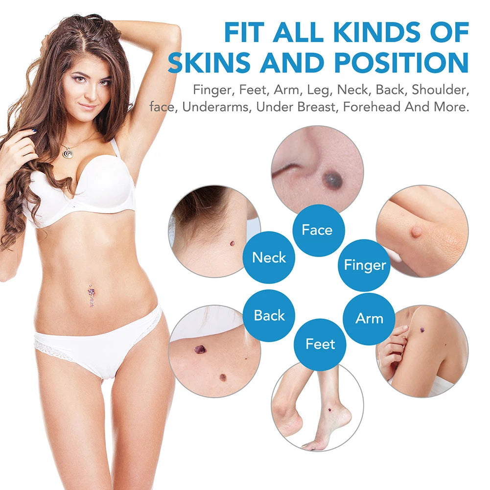 2-in-1 Skin Tag & Wart Remover Kit
