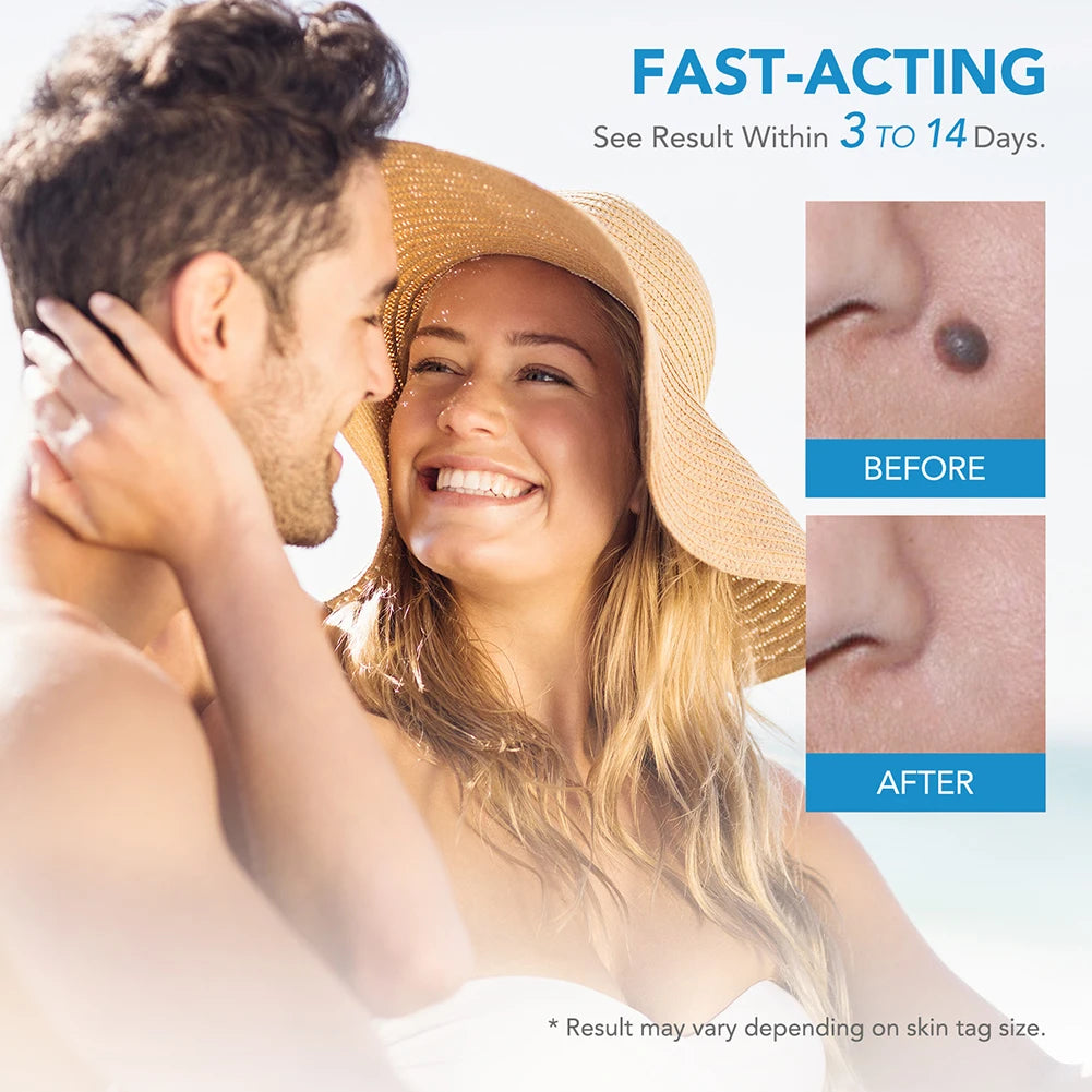 2-in-1 Skin Tag & Wart Remover Kit