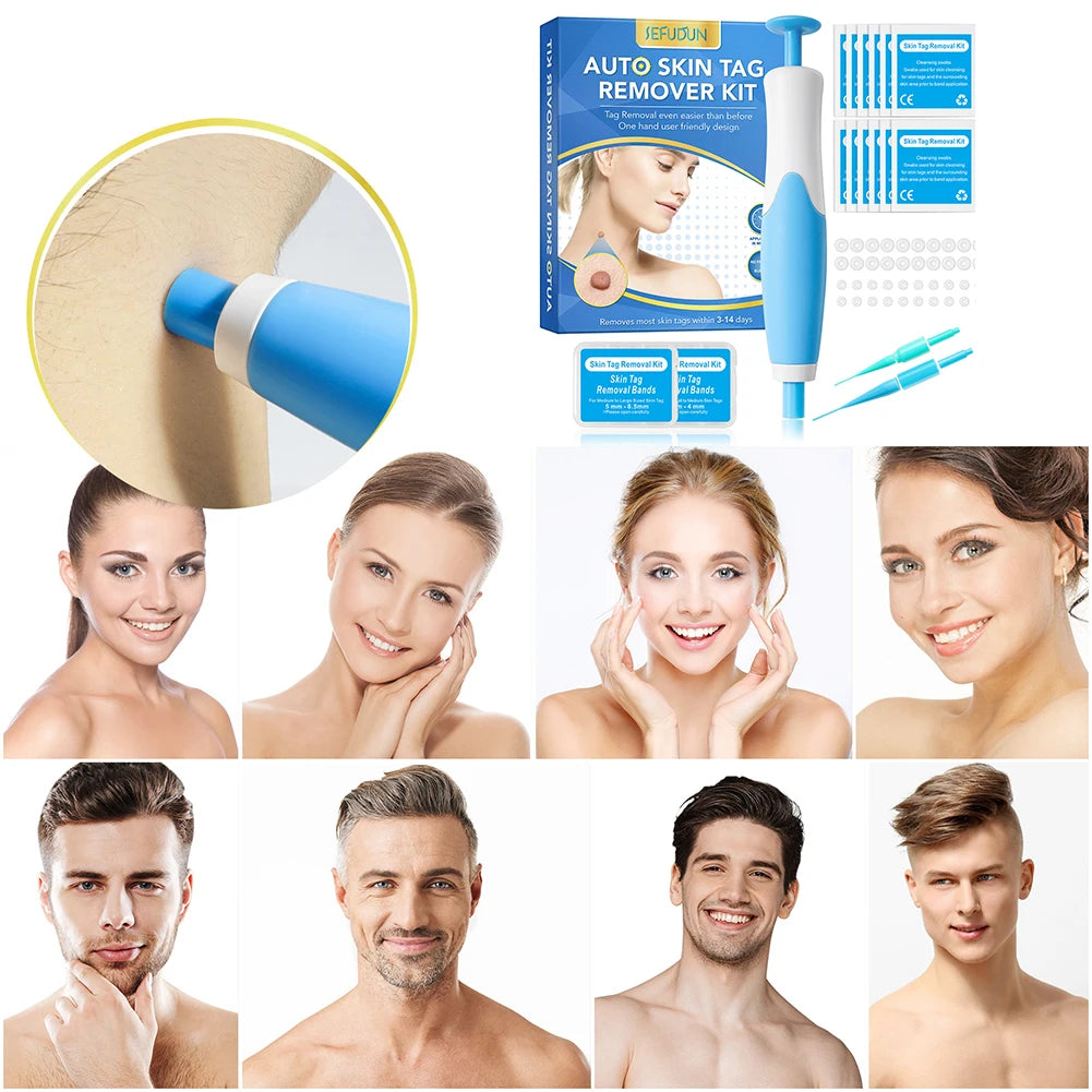 2-in-1 Skin Tag & Wart Remover Kit