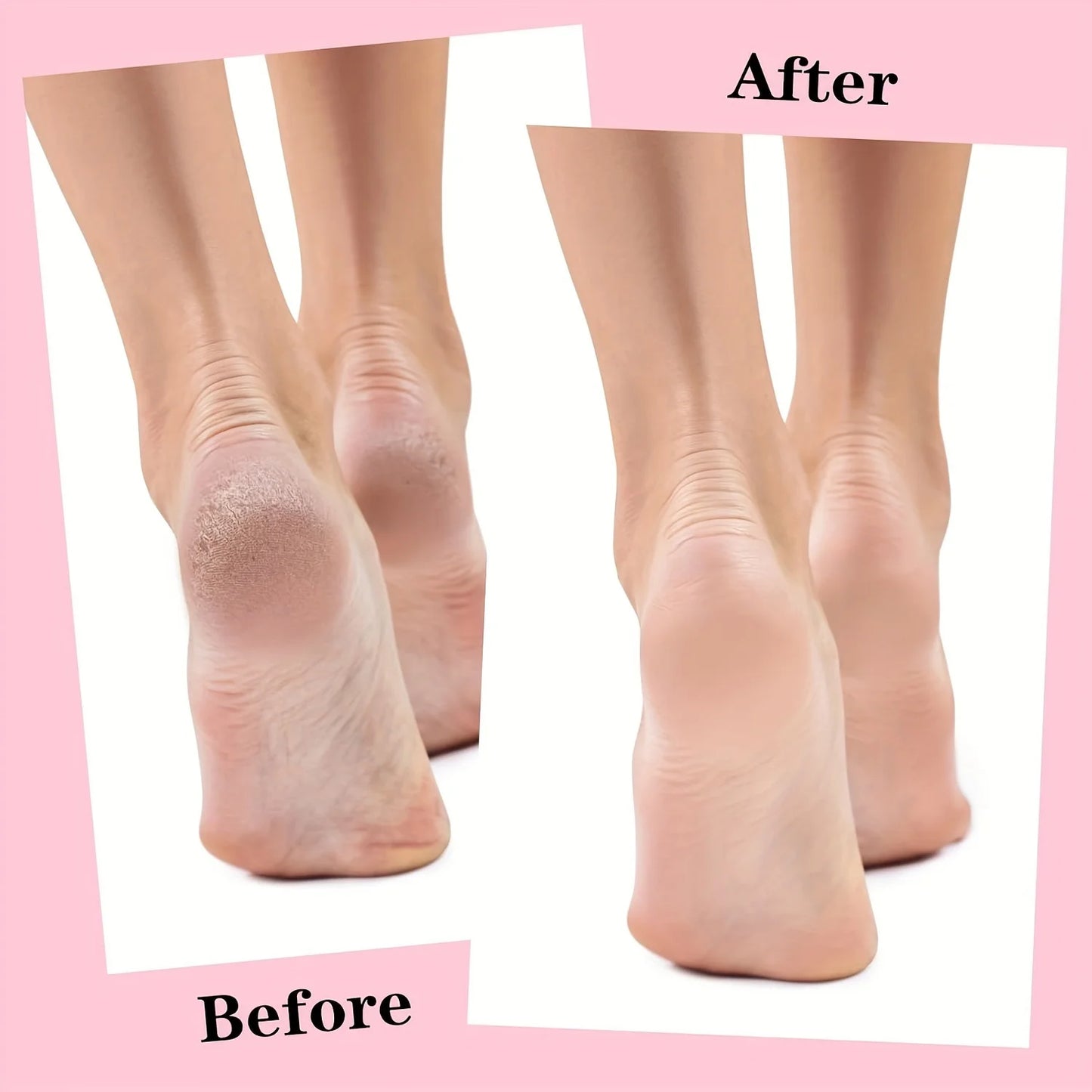 Silicone Gel Moisturizing Foot Socks - Dry & Cracked Heel Repair, Pedicure Care (1 Pair)