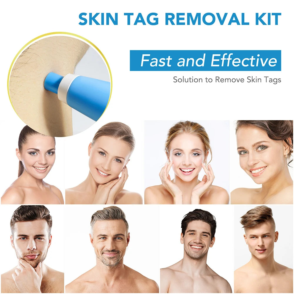 2-in-1 Skin Tag & Wart Remover Kit