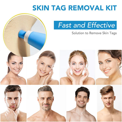 2-in-1 Blemish & Skin Spot Removal Tool Kit