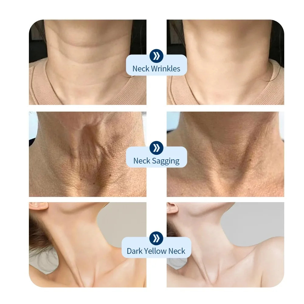 LED Neck Beauty Mask — 7-Color Photon Therapy for Anti-Wrinkle & Skin Tightening - Flexivo