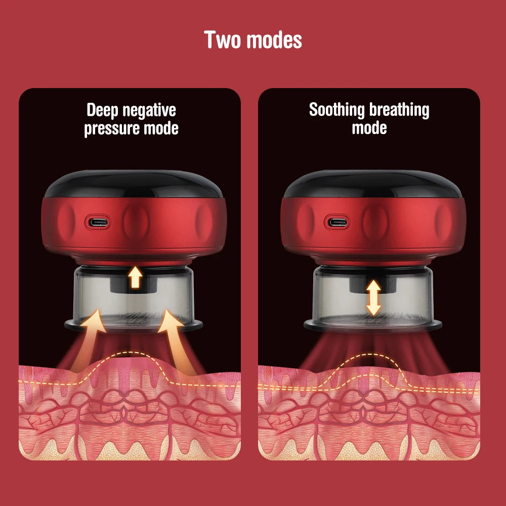 Smart Electric Cupping Device for Vacuum Therapy, Guasha Scraping & Red Light Heating - Flexivo