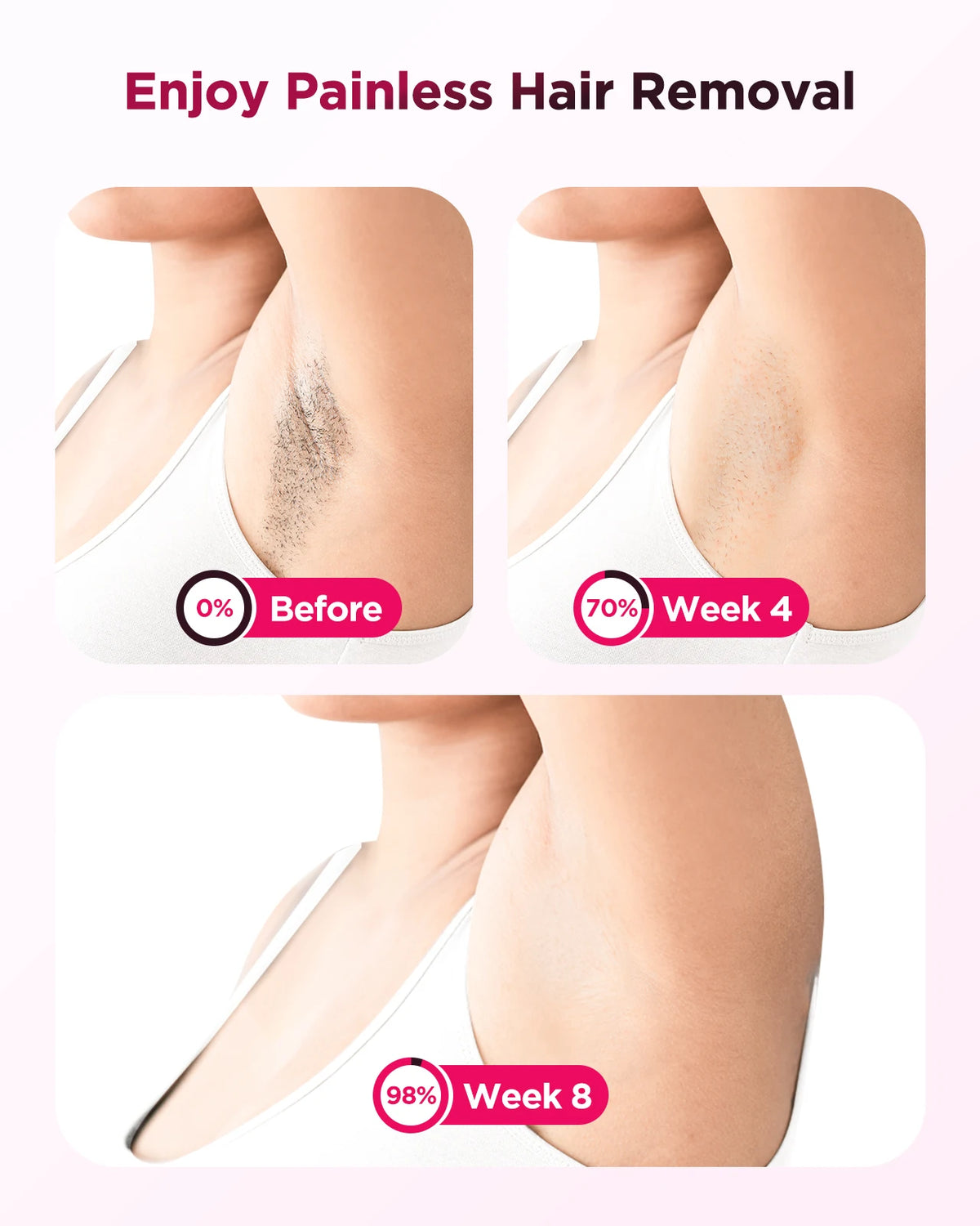 IPL Hair Removal Device with US Plug