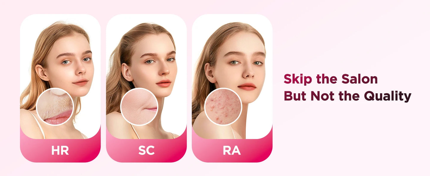 IPL Laser Hair Removal Device – 990,000 Flashes, Permanent Painless Hair Remover for Face, Body & Bikini