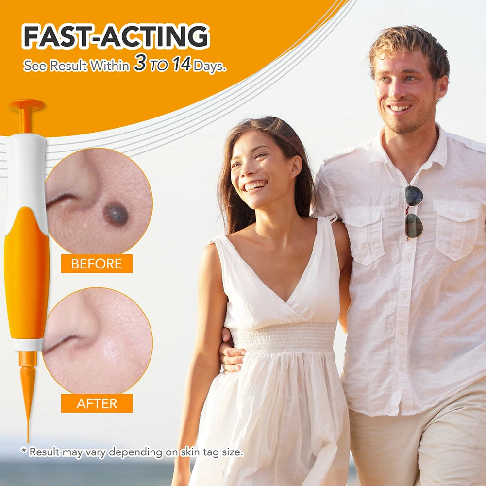 2-in-1 Skin Tag & Wart Remover Kit