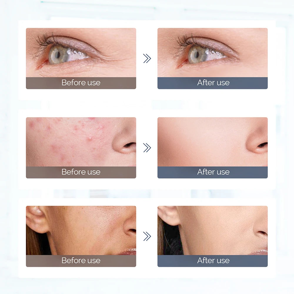 7-Color LED Light Therapy Face Mask - Silicone Skin Care Beauty Device for Home Use