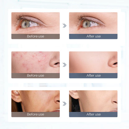 7-Color LED Light Therapy Face Mask - Silicone Skin Care Beauty Device for Home Use